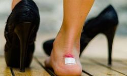 Ayakkabı vurduğunda oluşan yaralara 5 etkili çözüm: Birkaç kullanımda yaralarını hızlıca iyileştiriyor...