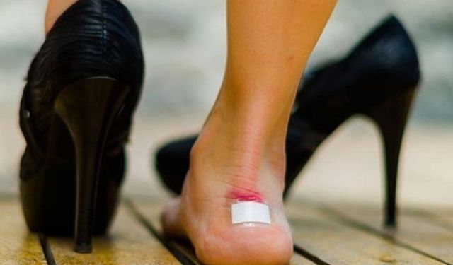 Ayakkabı vurduğunda oluşan yaralara 5 etkili çözüm: Birkaç kullanımda yaralarını hızlıca iyileştiriyor...